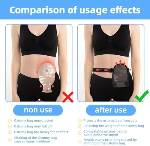 Universal stoma pouch cover with adjustable elastic waist belt