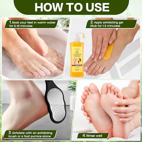 Step by step application of XIWEIOO callus remover gel on rough feet.