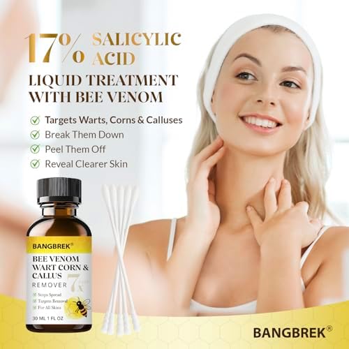 Maximum strength 17 percent salicylic acid wart remover for feet