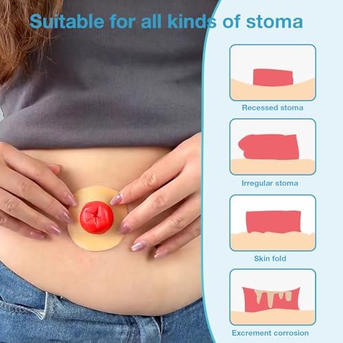 TNTNDAY elastic skin extender rings illustrating the flexible two millimeter thickness.