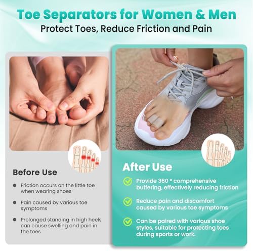 Pnrskter foot care sleeves protecting toes inside running shoes