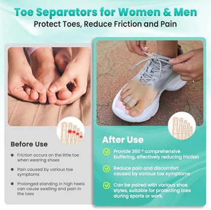Pnrskter foot care sleeves protecting toes inside running shoes