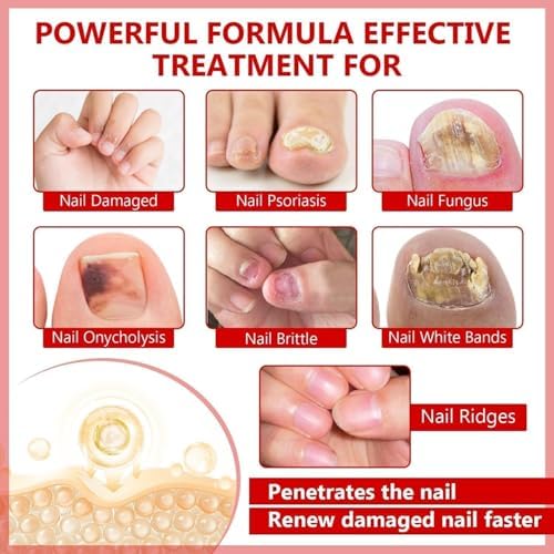 Comparison of damaged nail versus healthy nail regrowth after using ERISAMO treatment.