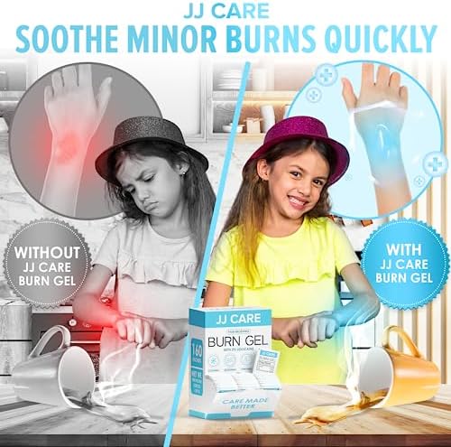 Bulk pack of 160 sterile burn gel packets for kitchen and home safety.
