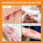 Applying Medagel hydrogel pad to a minor kitchen burn for instant cooling
