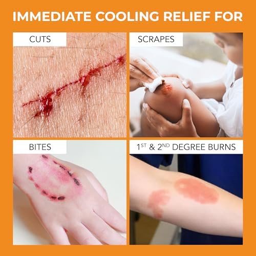 Applying Medagel hydrogel pad to a minor kitchen burn for instant cooling
