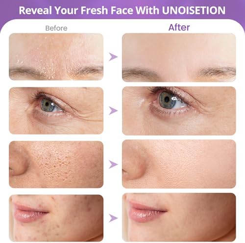 Side view of the UNOISETION blackhead removal machine showing adjustable suction settings