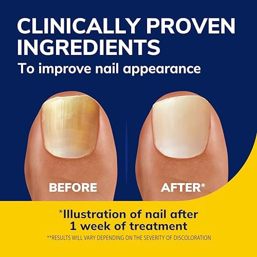 Before and after visualization of nail lightening using Dr. Scholl's triple action formula.