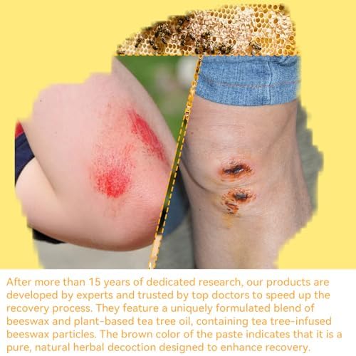 DRUOUO bed sores cream packaging highlighting Calendula and Aloe ingredients.