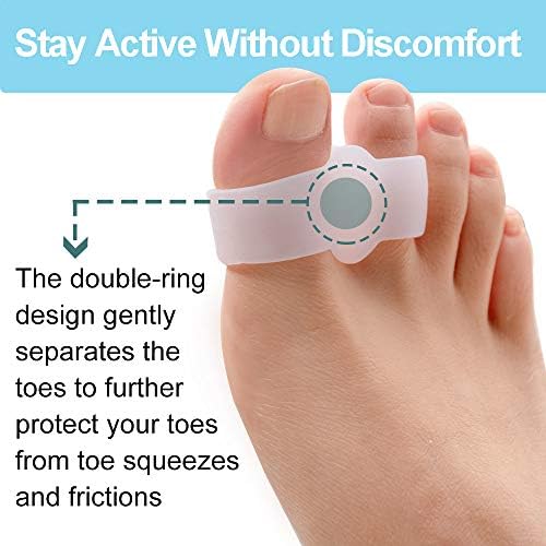 Welnove gel spacers being worn on a foot to separate overlapping toes.