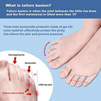 Anatomical placement of the bunionette pain relief cushion on the outer foot