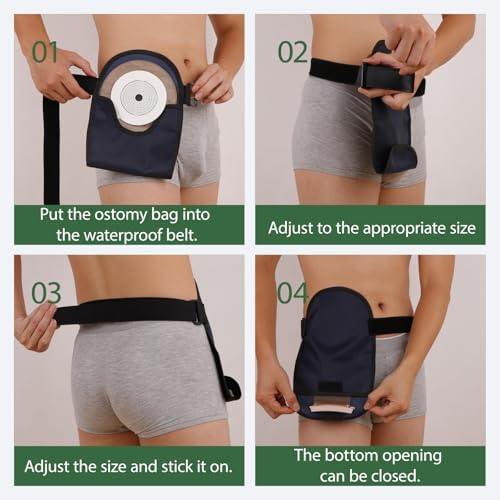 Stoma flange opening design on AxuuRmvin bag cover