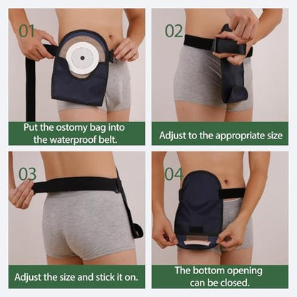 Stoma flange opening design on AxuuRmvin bag cover
