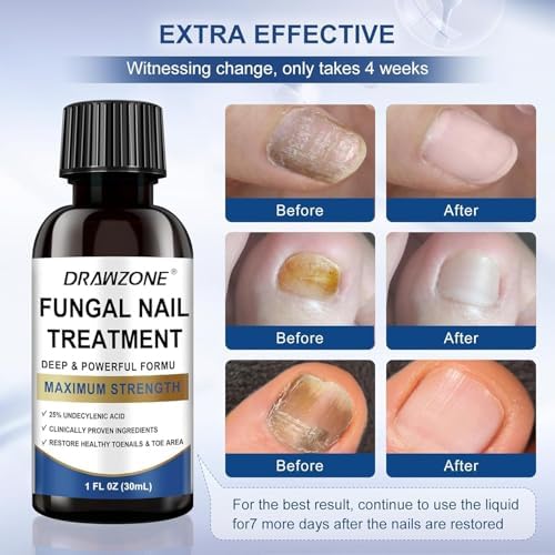 Drawzone nail repair solution showing 4 pack bottles for long term foot care.