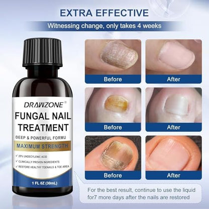 Drawzone nail repair solution showing 4 pack bottles for long term foot care.