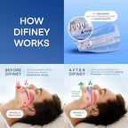 Side profile of Difiney anti-snoring device highlighting the adjustable jaw settings.