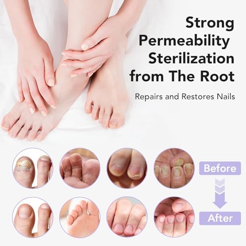 Authentic USA imported Ourui One nail fungus treatment packaging
