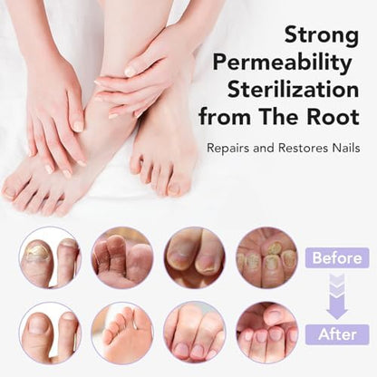 Authentic USA imported Ourui One nail fungus treatment packaging