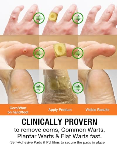 Close up of Samsali corn remover pad with cushioned protective ring