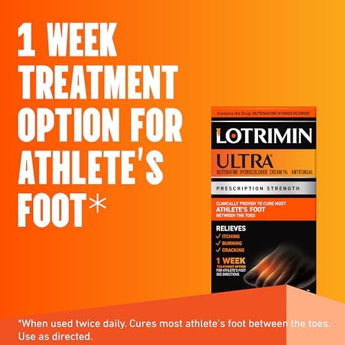 Lotrimin Ultra prescription strength butenafine hydrochloride one percent antifungal cream tube