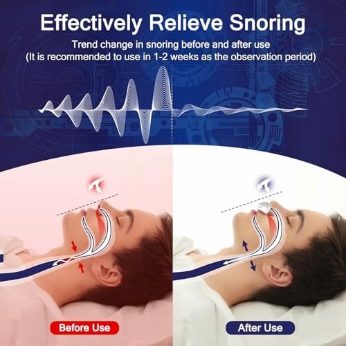 Adjustable wind speed control button on white electronic snoring stopper.