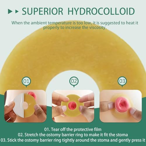 Authentic USA imported medical stoma rings designed for sensitive skin protection and extended wear