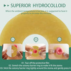 Authentic USA imported medical stoma rings designed for sensitive skin protection and extended wear