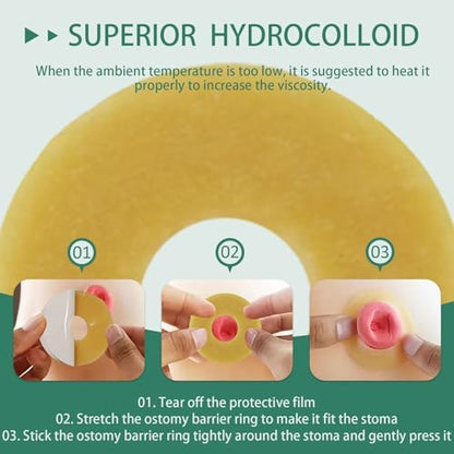 Authentic USA imported medical stoma rings designed for sensitive skin protection and extended wear