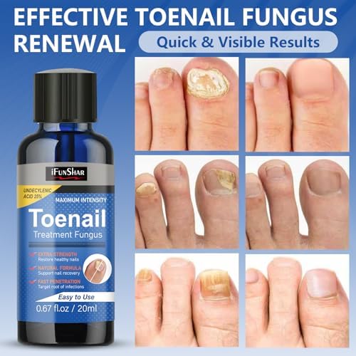 Drawzone extra strength formula for treating ingrown and discolored nails
