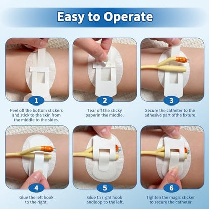 Catheter tube securement mechanism detail