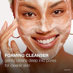 Acne face wash with MicroClear technology targeting pimples and blackheads
