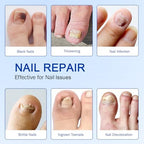 Fanshi nail care patches applied on toenail demonstration