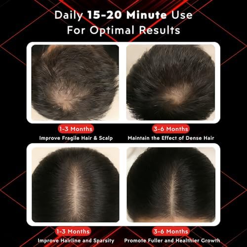 GlowFars wireless scalp care cap side profile