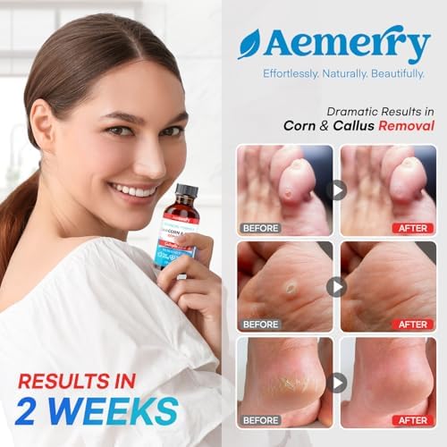 Aemerry maximum strength seventeen percent salicylic acid liquid dropper bottle setup.