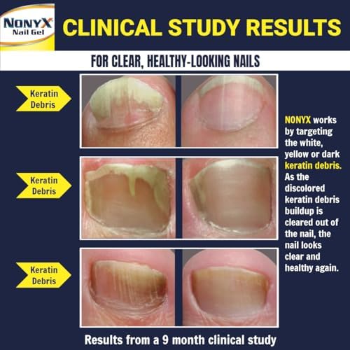 Nonyx toenail and fingernail clarifying gel instructions and usage panel
