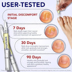 Application of the antifungal serum on a toenail using the mess free pen.