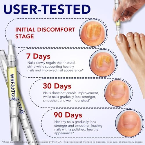 Application of the antifungal serum on a toenail using the mess free pen.