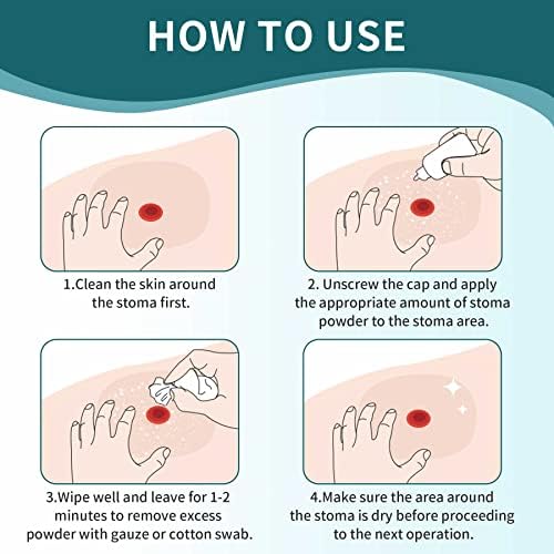 Squeeze bottle mechanism of Ovand ostomy skin care powder showing ease of use