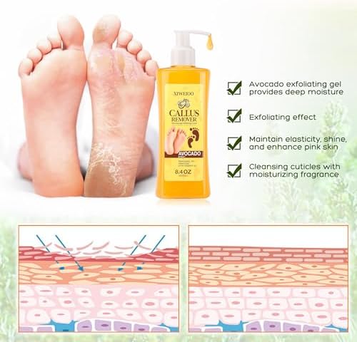 Home pedicure spa set including callus softener gel and pumice stone.