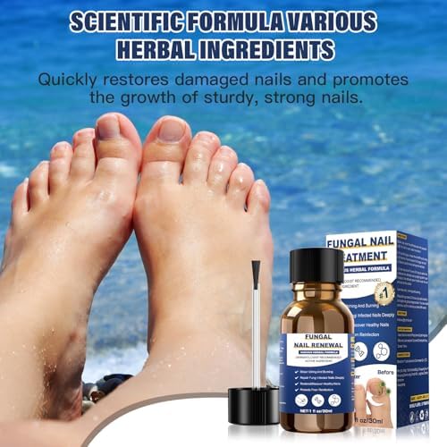 Sechkiss fungal nail treatment showing ingredients and usage directions on label.