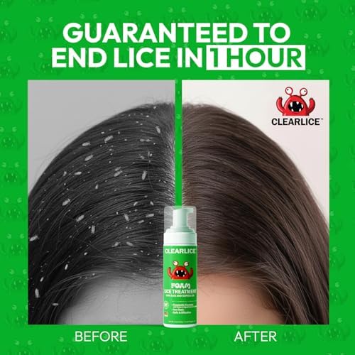 Authentic Clearlice USA imported lice treatment packaging