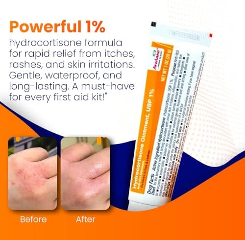 Maximum strength anti itch ointment with aloe vera for skin rashes.