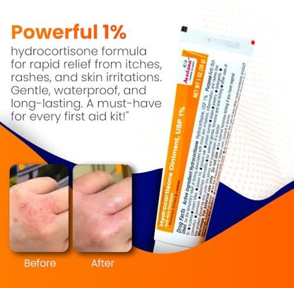 Maximum strength anti itch ointment with aloe vera for skin rashes.