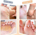 Z:sea foot spa treatment five pack details