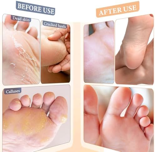 Back label of the foot mask showing details on urea and shea butter ingredients.
