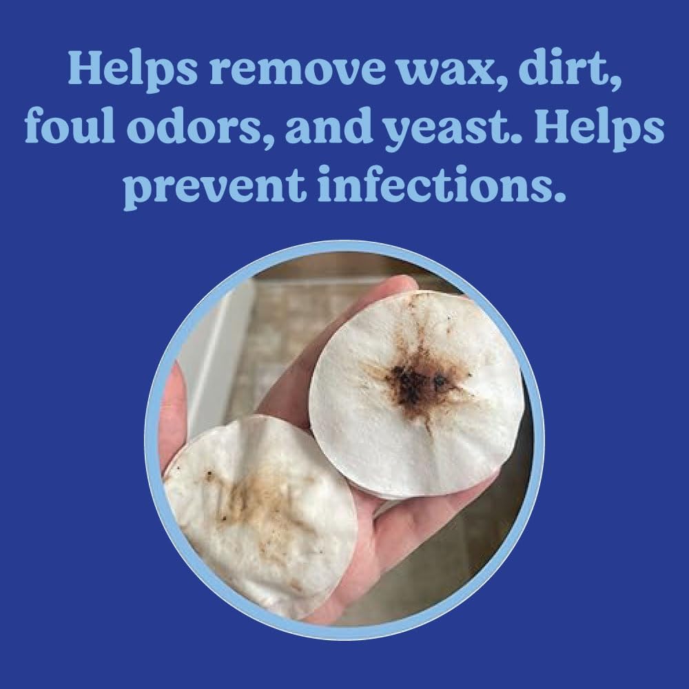 Angels' Eyes ear wipes showing pre-moistened texture