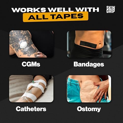 Skin Grip wipes being used for painless Dexcom patch removal