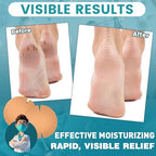 TEAWOO beige cotton foot adhesive patch demonstrating the flexible curved design.