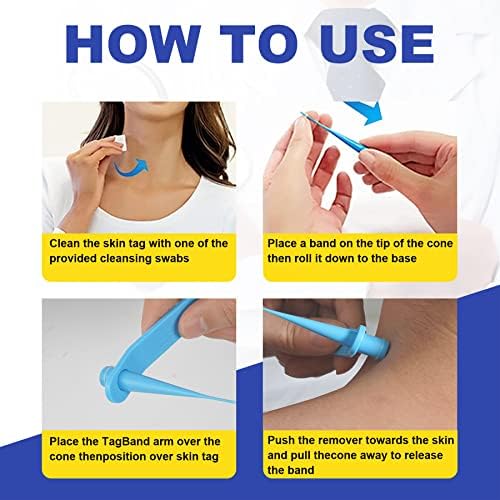 Side view of the skin tag removal tool showing the ergonomic grip.