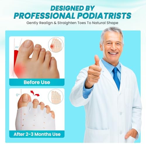 Side view of JNATER toe spacers being worn on a human foot